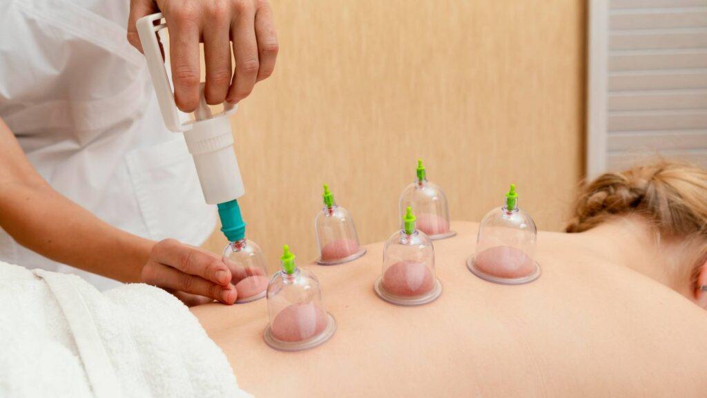 Cupping-Massage-for-Beginners-image