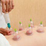 Cupping-Massage-for-Beginners-image