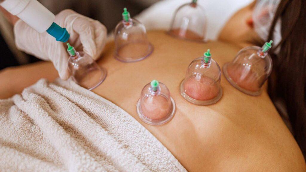 Cupping-Massage-for-Women-image