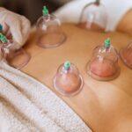 Cupping-Massage-for-Women-image