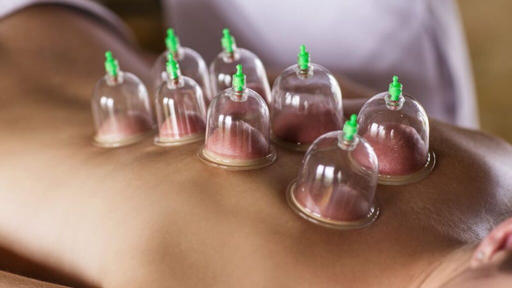 Dubai-Cupping-Massage-image