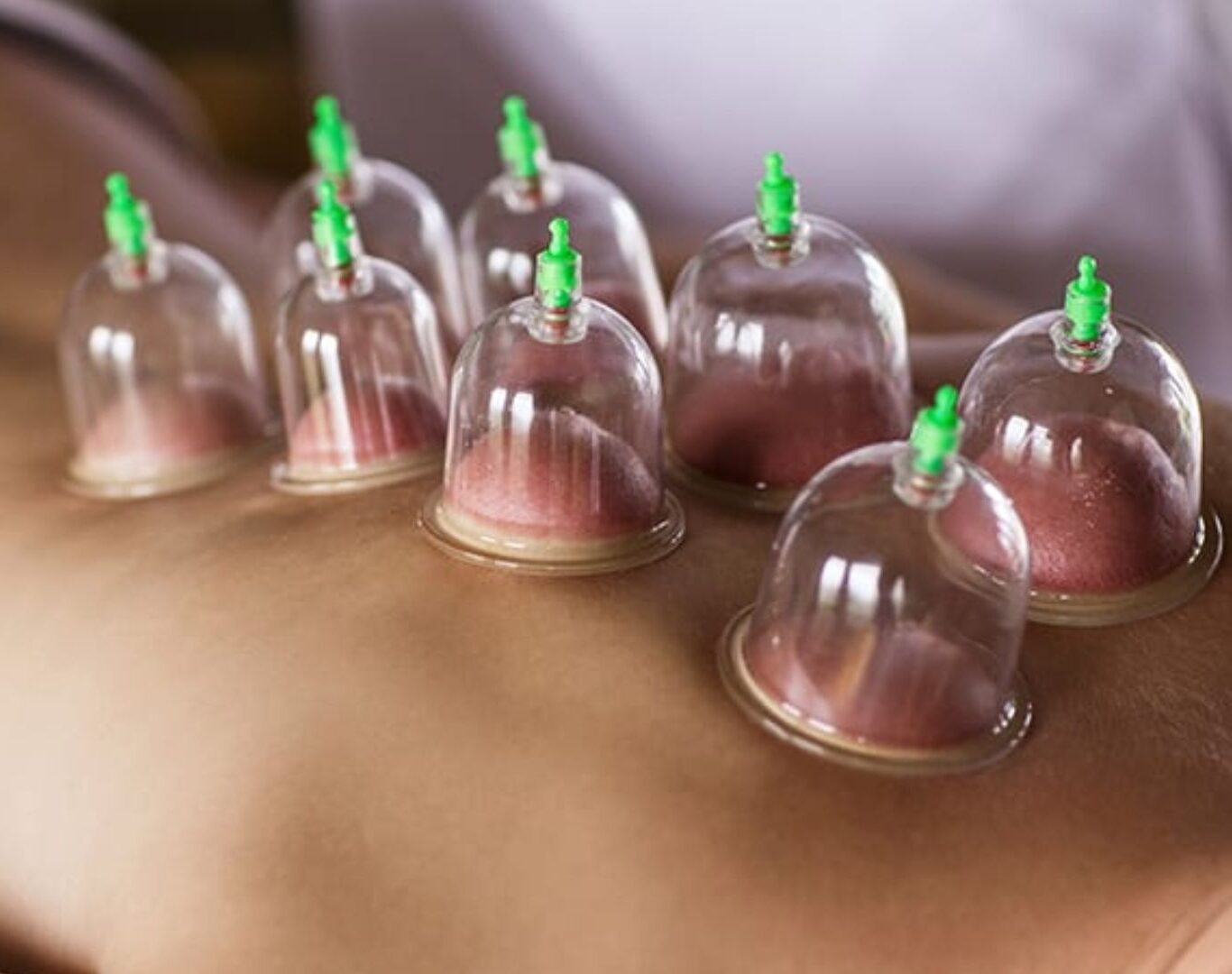Dubai-Cupping-Massage-image