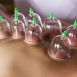 Dubai-Cupping-Massage-image